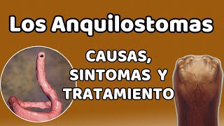 LOS ANQUILOSTOMAS Causas signos y síntomas diagnóstico y tratamiento [upl. by Zobe]