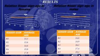 Risser stages menarche and other growth parameters in idiopathic scoliosis patients [upl. by Kcerred]