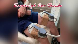 Emsculpt Treatment for Thighs and Quads [upl. by Maretz]