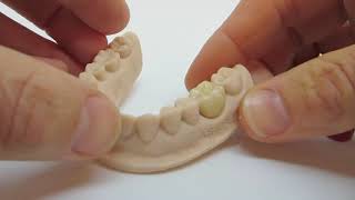 Asiga DentaMODEL for crown and bridge sgdentalshopcom [upl. by Ferdie1]