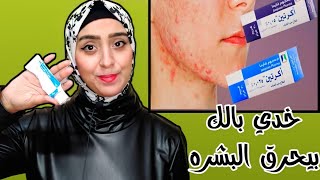 تجربتي مع الأكرتين وطريقة الاستخدام الصحيحة لتقشير البشرة [upl. by Alejandra]