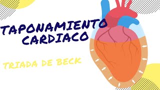 TAPONAMIENTO CARDIACO TRIADA DE BECK ¿Qué debes saber sobre esta emergencia médica [upl. by Llertnac916]