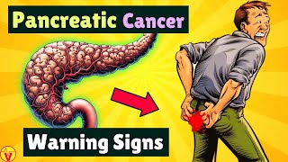 10 Warning Signs of PANCREATIC CANCER That Will SHOCK You  VisitJoy [upl. by Haridan]