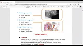 Medical Emergencies in Dental Office [upl. by Leesa76]