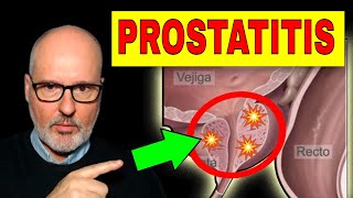 PROSTATITIS AGUDA y CRÓNICA Síntomas Causas y Tratamiento [upl. by Drucie]