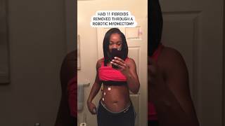 🤯11 FIBROIDS REMOVED How’s Life Now…fibroids fibroidremoval fitnessmotivation momoftwins [upl. by Lemon321]