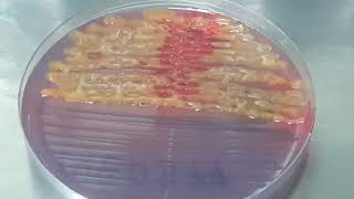 Serratia fonticola on CLED Agar Uropathogen [upl. by Ecenaj]