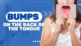 Bumps On The Back Of The Tongue 5 Symptoms And Rare Causes [upl. by Nylessoj]