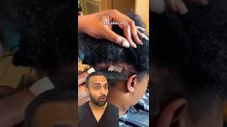 The Importance Of Treating Scalp Psoriasis  Dr Somji Explains [upl. by Sitnalta]