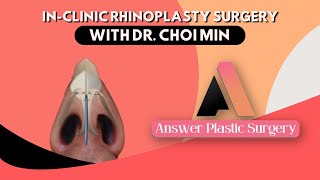 Transforming Lives InClinic Rhinoplasty Surgery with Dr Choi Min  Answer Plastic Surgery [upl. by Aerb]