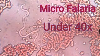 Falaria under 40x microscope [upl. by Eniledam]