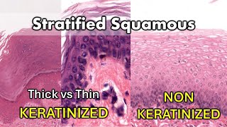 Keratinized vs Non Keratinized Thick vs Thin [upl. by Galateah600]