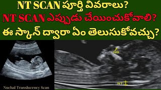 NT Scan during 3 months pregnant in telugu  NT scan full details in teluguntscan thanvivlogs [upl. by Artema792]