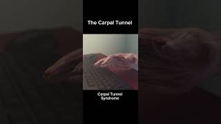 The Carpal Tunnel Syndrome in 22 seconds😯 [upl. by Melodee]