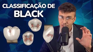 Classificação de Black classificação das cavidades dentais  Lucas Venâncio [upl. by Ekralc]