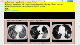 RADIOLOGY EXAM CASES [upl. by Ysac]