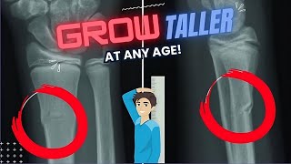 Your Growth Plates NEVER Close heightgrowth growtaller [upl. by Tiat]