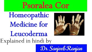 psoralea Corylifolia homeopathic medicine for leucoderma psoralea Corylifolia q uses in hindi [upl. by Garrek]