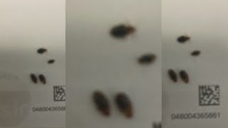 Bed bug infestation at Redwood City assisted living facility continues resident says [upl. by Ailugram911]