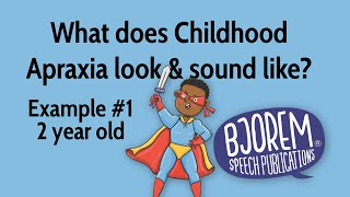 Childhood Apraxia of Speech  Example 1 [upl. by Llenaej]