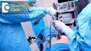 What is the advantage of Laparoscopy Surgery  Dr Nupur Sood [upl. by Ile]