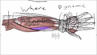 Wrist Tendonitis Symptoms Basics  What Actually Causes Them [upl. by Nadoj47]