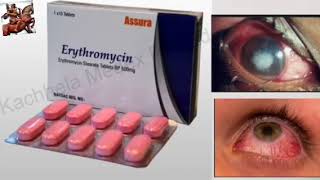 Antibiotic tablet ।। Erythromycin ।। Eye infection ।। Optometry Solution [upl. by Speroni931]