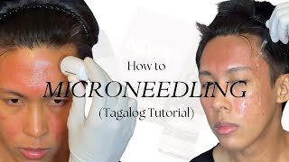 How to Microneedle Tagalog using New Skin New Me  Acne Scar Repair Kit by TCC [upl. by Siocnarf239]