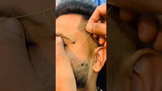 Mole amp Wart Removal Explained by Dr Ragini  Skin amp Hair Clinic Guntur [upl. by Ardnuaed]