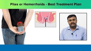 Best treatment for piles or hemorrhoids  Dr Anantha Krishna  Nano hospitals bengaluru [upl. by Ahselat]