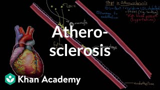 Atherosclerosis  Circulatory System and Disease  NCLEXRN  Khan Academy [upl. by Dearr436]