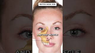 WILL BOTOX REALLY FIX YOUR NOSE [upl. by Ydnamron]