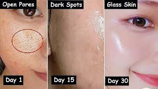 Damaged Skin Repair in 30 Days Close LARGE OPEN PORES amp Remove Dark Spots [upl. by Oiretule]