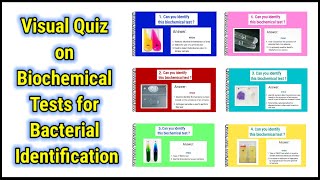 Visual Quiz on Biochemical tests for identification of bacteria  basicappliedmicrobiology [upl. by Pond]