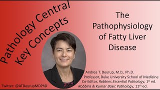 Medical School Pathology The Pathophysiology of Fatty Liver Disease [upl. by Jehu]