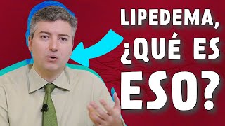 Lipedema enfermedad crónica del tejido adiposo [upl. by Aicala962]