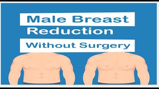 Gynecomastia Treatment gynecomastia gynecomastiacauses gynecomastiaresultyoutube [upl. by Marieann479]