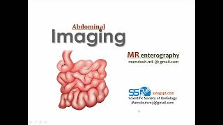 3 MR enterography technique amp clinical applications Prof Mamdouh Mahfouz [upl. by Valaree623]