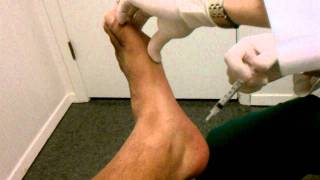 This is what a cortisone injection looks like Ouch [upl. by Grew]