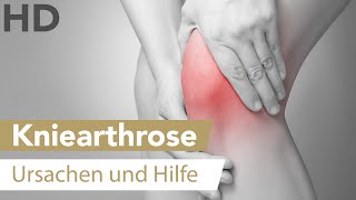 Arthrose im Kniegelenk Wie sie entsteht amp was du tun kannst [upl. by Silas]