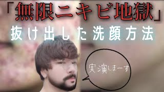 【ニキビ肌を改善してきた洗顔方法を実演します！】ただ僕自身洗顔についてわからなくなっています [upl. by Mort]