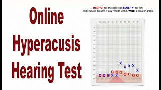 Hyperacusis Online Hearing Test Lowest Discomfort Level or LDL [upl. by Oisinoid]