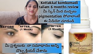 Kumkumadi Tailam Review After Using 6 months  Kottakkal Kumkumadi Tailam I Sujay Vlogs [upl. by Suicul]