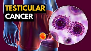 Testicular Cancer Causes Signs and Symptoms Diagnosis and Treatment [upl. by Seldan]