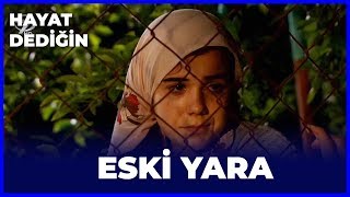 Hayat Dediğin  Eski Yara [upl. by Ardnaeel243]