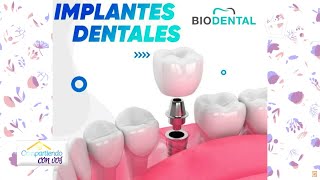 Implantes Dentales procedimiento y tipos  COMPARTIENDO CON VOS [upl. by Ventura]