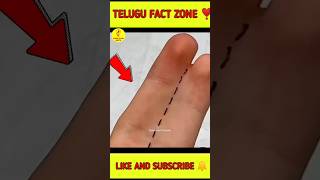 🔥This is very dangerous disease 🤯viral short facts tejesh india 🇮🇳 [upl. by Eurydice83]