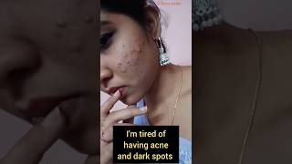 HOW TO GET CLEAR SKINEASY SKIN CARE ROUTINE ✨skincare skinbrightening skincareroutine acne [upl. by Nnyluqcaj278]