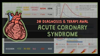 12 DIAGNOSIS DAN TERAPI SINDROM KORONER AKUT 2 ISCHEMIC HEART DIASEASE [upl. by Narmis]