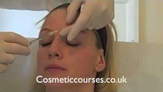 Botox training 3 Botox injection demonstration  Cosmetic Courses [upl. by Sekyere]